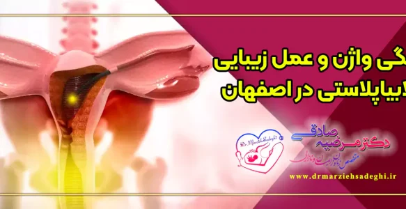 بهترین دکتر تنگی واژن و عمل زیبایی لابیاپلاستی در اصفهان