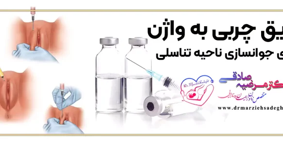 دکتر تزریق چربی به لابیا برای جوانسازی واژن در اصفهان