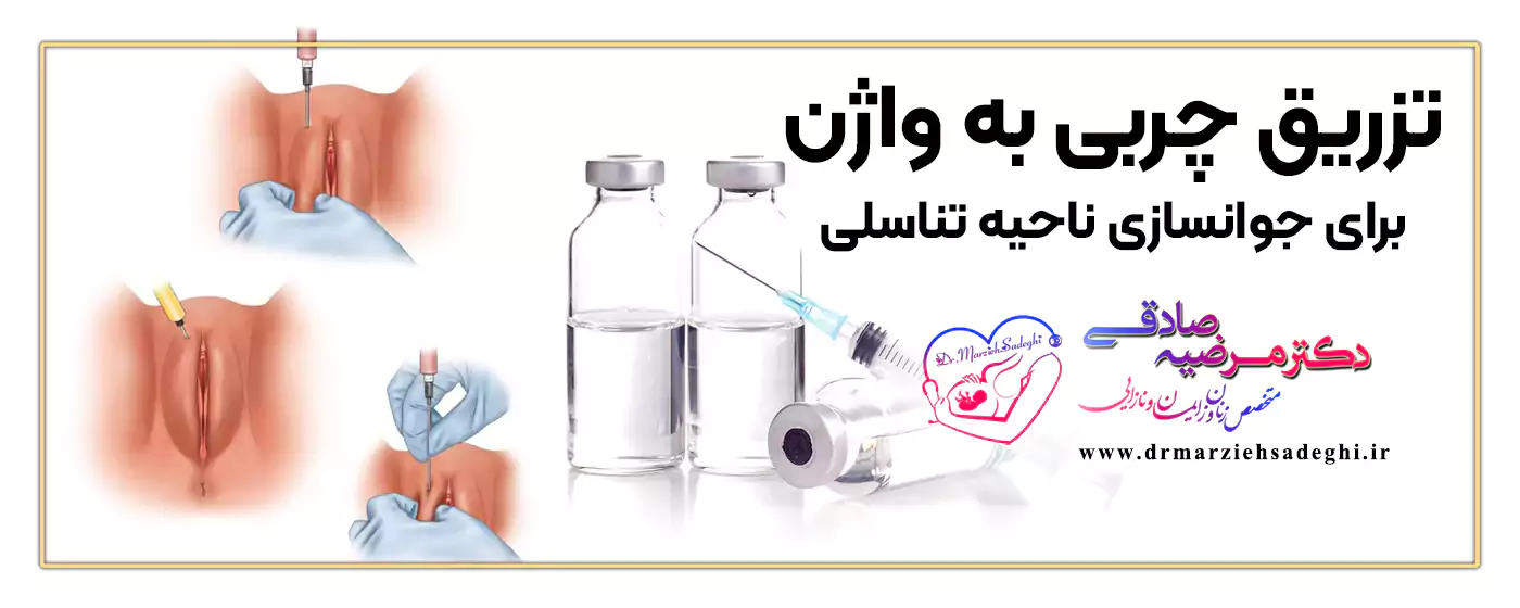 دکتر تزریق چربی به لابیا برای جوانسازی واژن در اصفهان